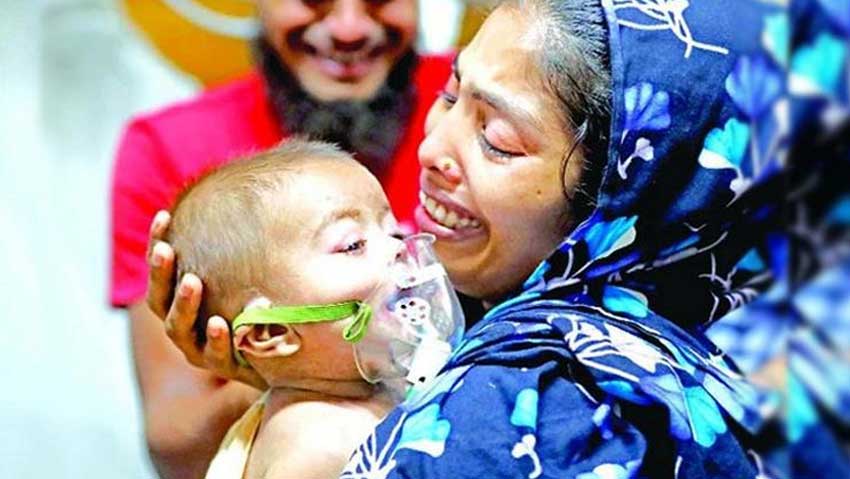 ২৪ ঘণ্টায় হাম উপসর্গে আরও ৬ জনের মৃত্যু